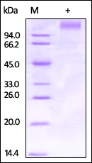 Ebolavirus Glycoprotein Recombinant Protein