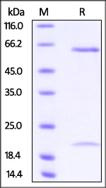 PCSK9 Recombinant Protein