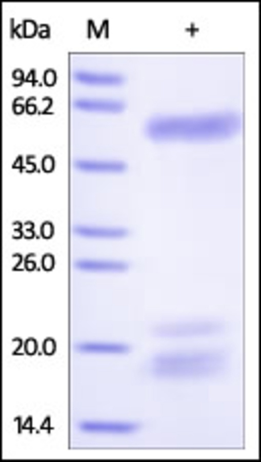 Osteopontin Recombinant Protein
