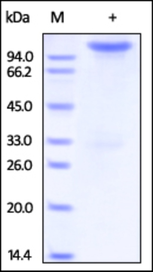 Neuropilin 1 Recombinant Protein