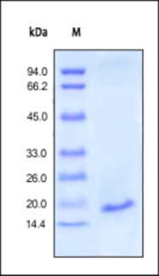 Interleukin 1b Recombinant Protein