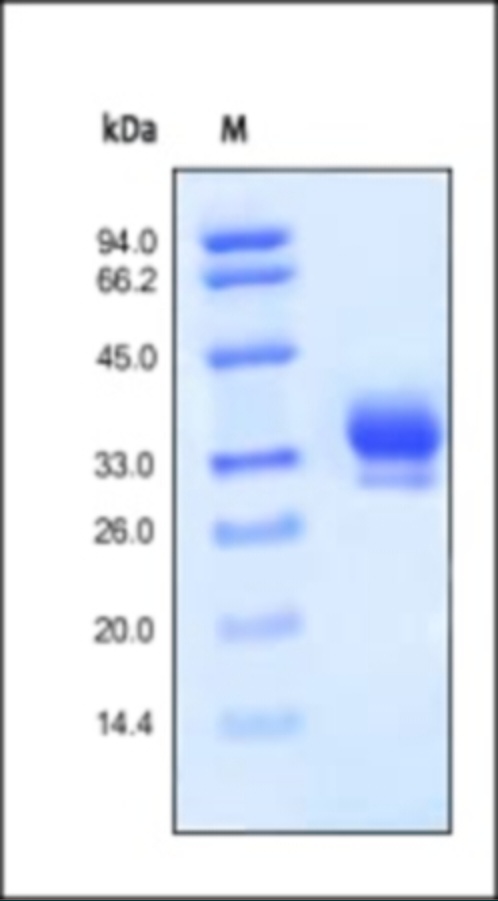 Interleukin 29 Recombinant Protein (HEK293 Expressed)