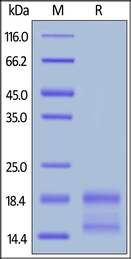 Interleukin 4 Recombinant Protein (HEK293 Expressed)