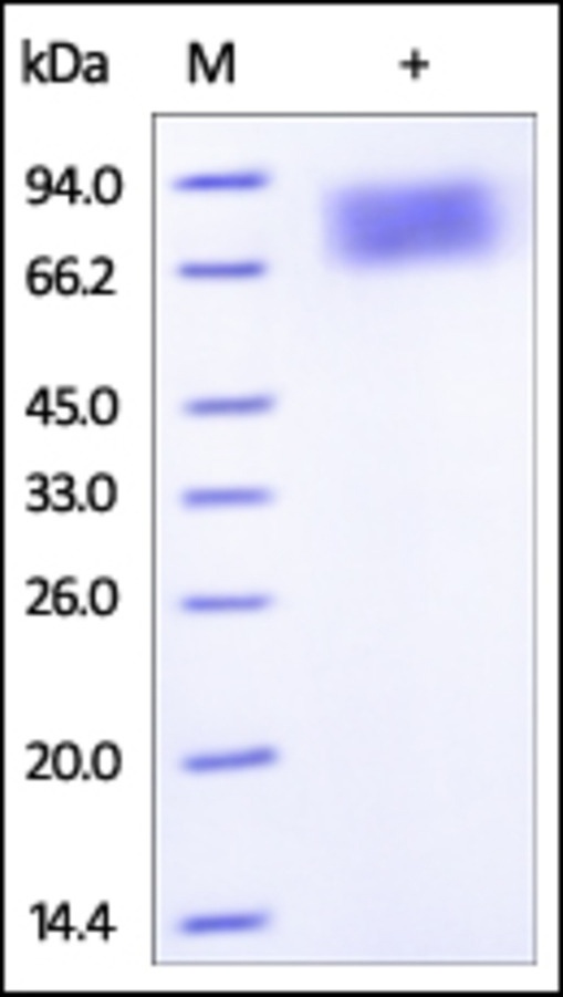 IFNAR 2 Recombinant Protein