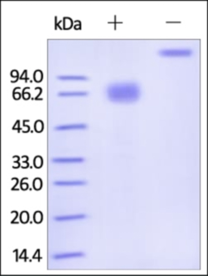IFNGR 1 Recombinant Protein