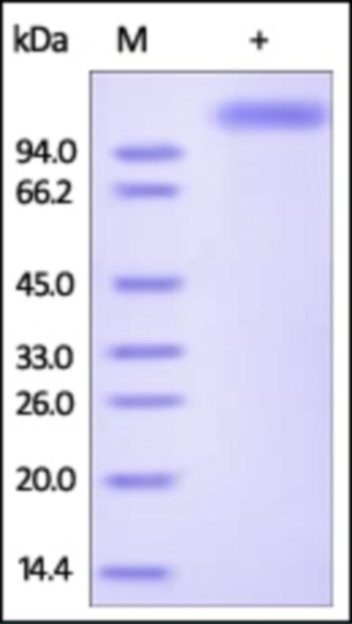 Influenza A Hemagglutinin Recombinant Protein