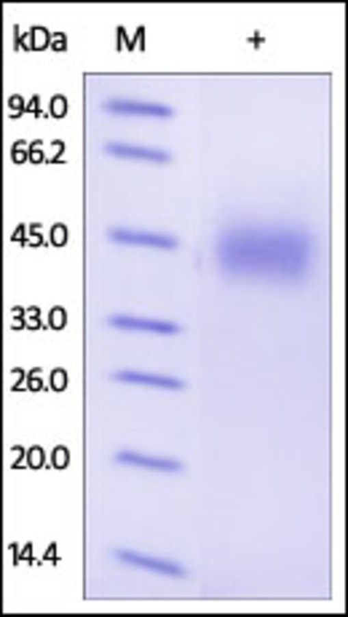 Growth Hormone Receptor Recombinant Protein