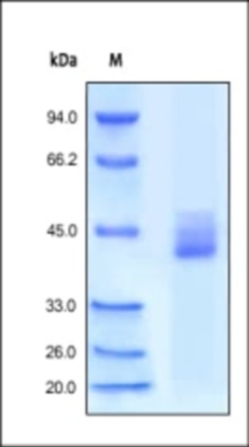 CXCR4 Recombinant Protein