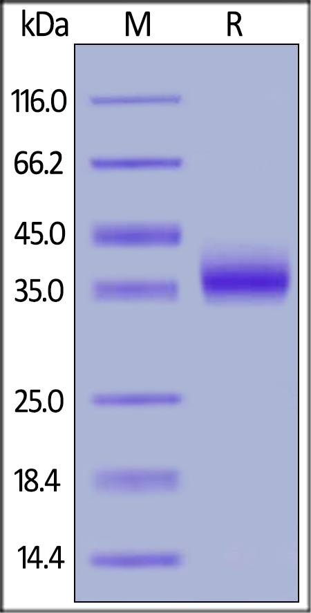 IL 2 R beta Recombinant Protein