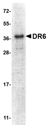 DR6 Extracellular Domain Recombinant Protein