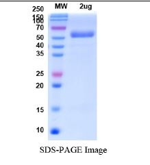 SARS-CoV-2 (COVID-19) Omicron Variant (B.1.1.529) Spike RBD Recombinant Protein