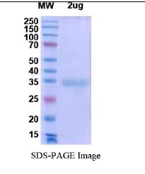 SARS-CoV-2 (COVID-19) Mu Variant (B.1.621) Spike RBD (R346K, E484K, N501Y, D614G, P681H) Recombinant Protein
