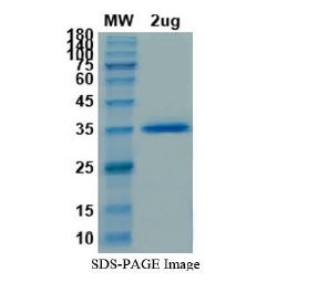 SARS-CoV-2 (COVID-19) Variant Spike Protein RBD (E484D) Recombinant Protein