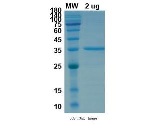 SARS-CoV-2 (COVID-19) Lambda Variant (B.1.1.1/C.37) Spike RBD (L452Q, F490S) Recombinant Protein