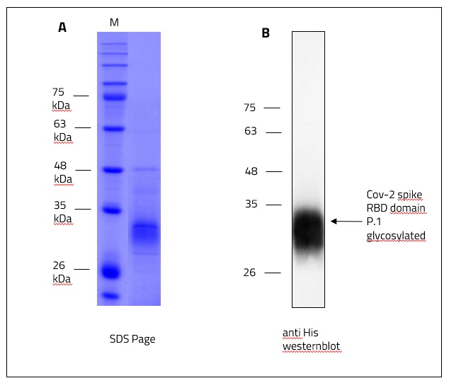 SARS-CoV-2 (COVID-19) Gamma Variant (P.1, Brazil) Spike RBD Recombinant Protein