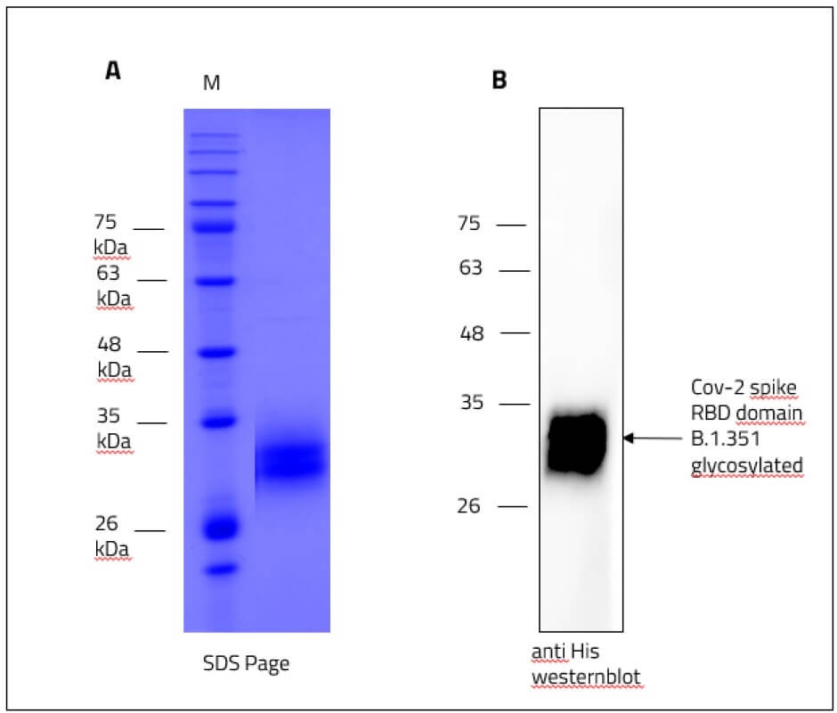 SARS-CoV-2 (COVID-19) Beta Variant ( B.1.351, SA) Spike RBD Recombinant Protein