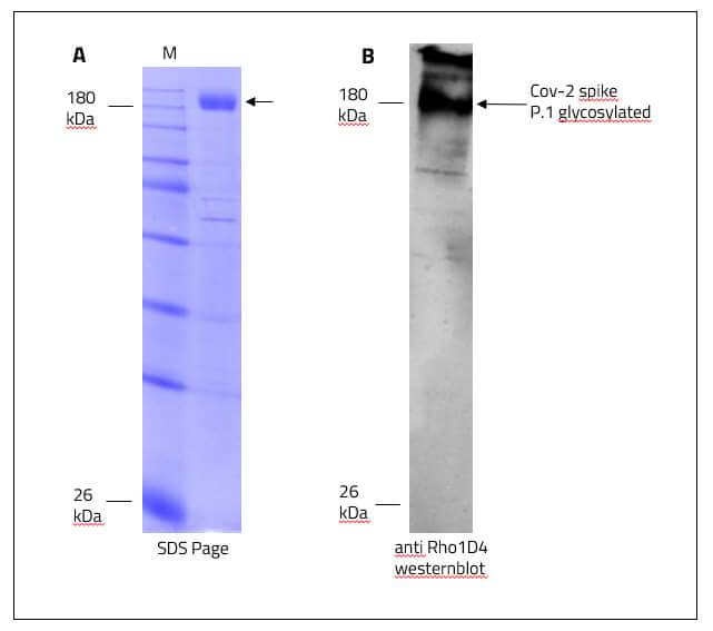 SARS-CoV-2 (COVID-19) Full-Length Gamma Variant (P.1, Brazil) Spike Recombinant Protein
