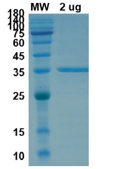 SARS-CoV-2 (COVID-19) Omicron Variant (B.1.1.529) Spike RBD Recombinant Protein