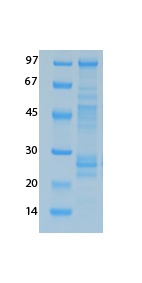 SARS-CoV-2 (COVID-19) NSP2 Recombinant Protein