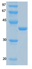 SARS-CoV-2 (COVID-19) NSP9 Recombinant Protein