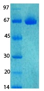 SARS-CoV-2 (COVID-19) NSP14 Recombinant Protein