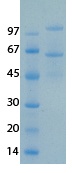 SARS-CoV-2 (COVID-19) NSP15 Recombinant Protein
