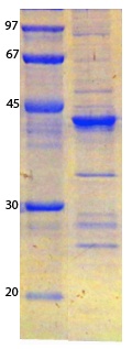 SARS-CoV-2 (COVID-19) ORF3B Recombinant Protein
