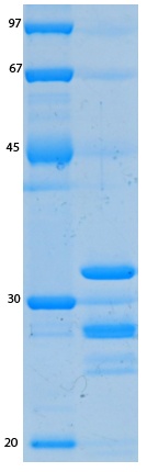 SARS-CoV-2 (COVID-19) ORF6 Recombinant Protein