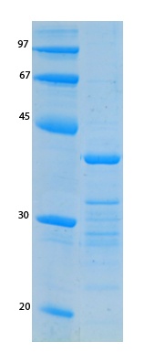 SARS-CoV-2 (COVID-19) ORF8 Recombinant Protein