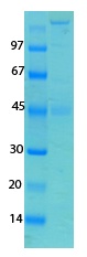 SARS-CoV-2 (COVID-19) Spike Recombinant Protein