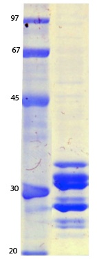 MERS Coronavirus Envelope (HSZ-Cc) Recombinant Protein