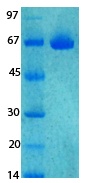 SARS-CoV-2 (COVID-19) NSP8 Recombinant Protein