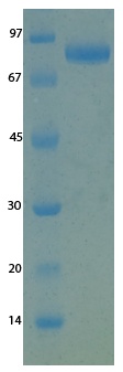 SARS-CoV-2 (COVID-19) NSP15 Recombinant Protein