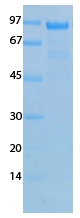 Human Coronavirus Nucleocapsid (229E) Recombinant Protein