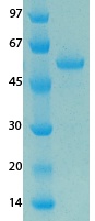 MERS Coronavirus Envelope (HSZ-Cc) Recombinant Protein