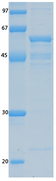 SARS-CoV-2 (COVID-19) ORF8 Recombinant Protein