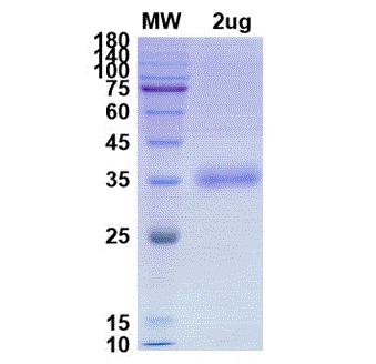 SARS-CoV-2 (COVID-19) Variant (B.1.160, 20A.EU2) Spike RBD (S477N) Recombinant Protein