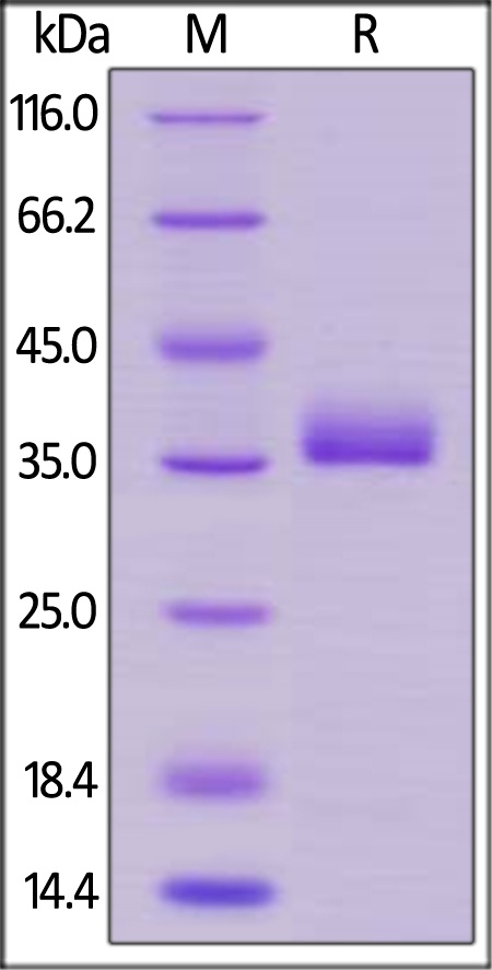 Prolactin R / PRLR Recombinant Protein