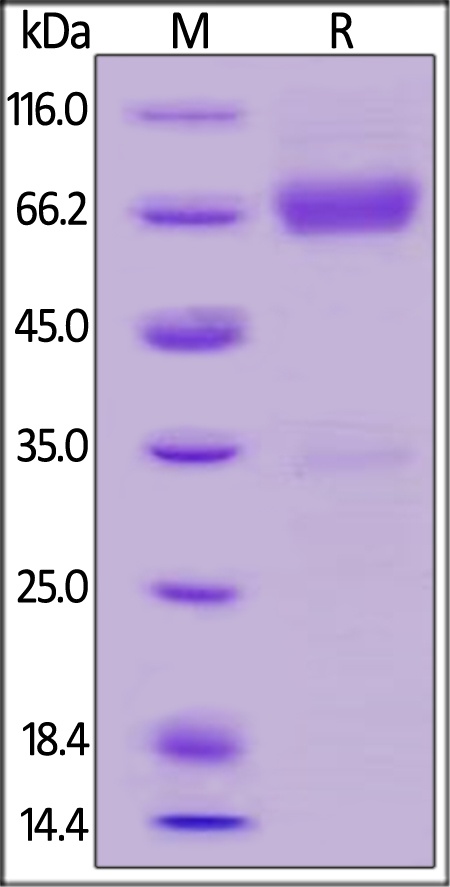 TSLP R Recombinant Protein