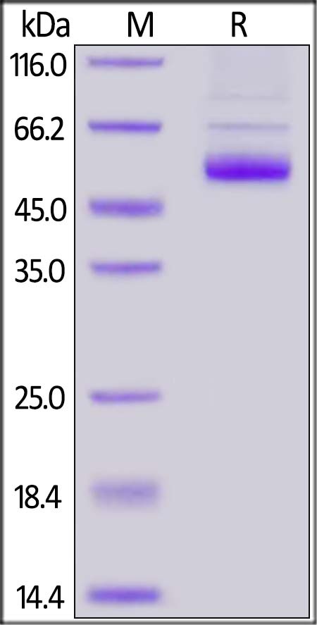 TNFSF11 / RANKL / CD254 Recombinant Protein