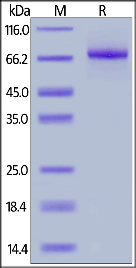 IL-12 R beta 1 / CD212 Recombinant Protein