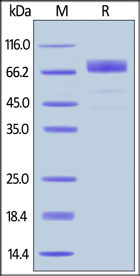 Rhesus macaque Growth Hormone R (GHR) Recombinant Protein