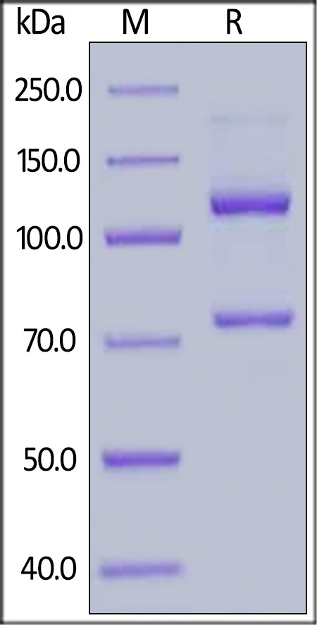 Complement C5 (w917s) Recombinant Protein