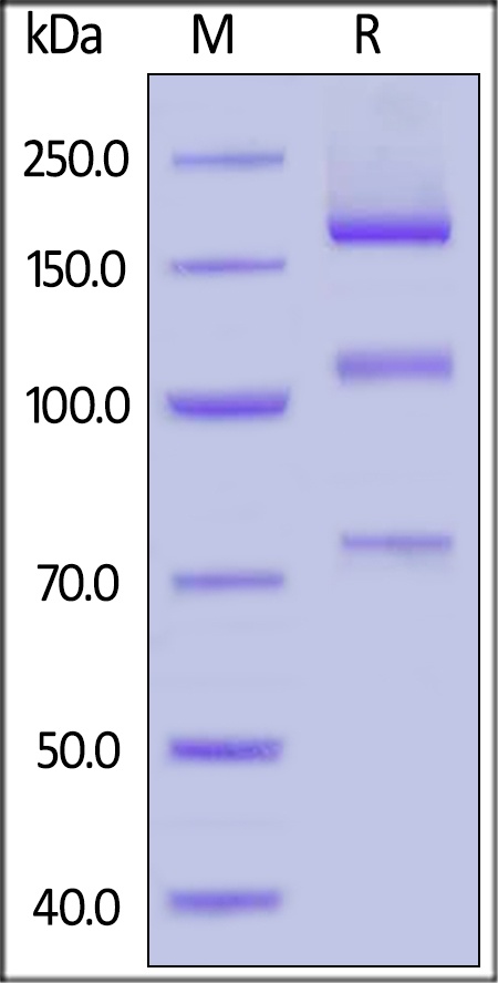 Complement C5 Recombinant Protein
