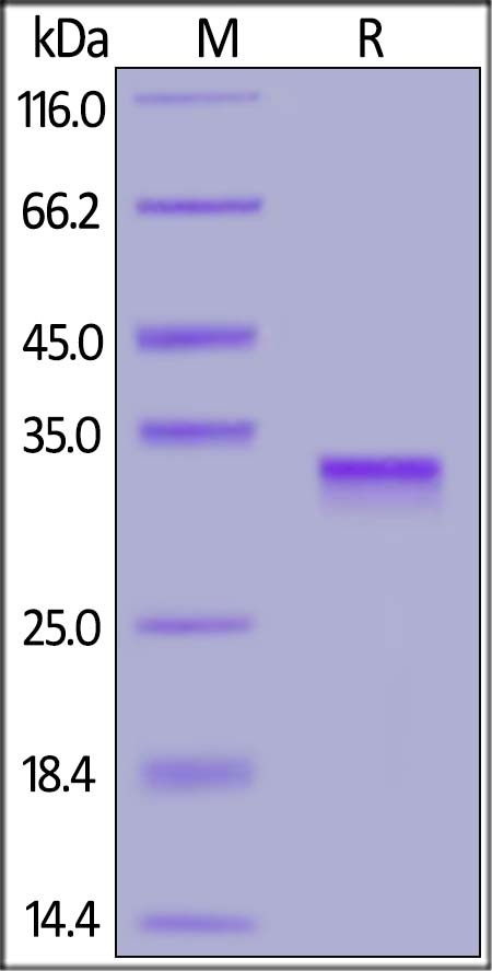 SARS-CoV-2 (COVID-19) S Recombinant Protein RBD