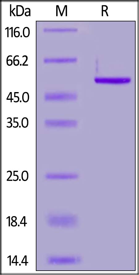 SARS-CoV-2 (COVID-19) Nucleocapsid Recombinant Protein