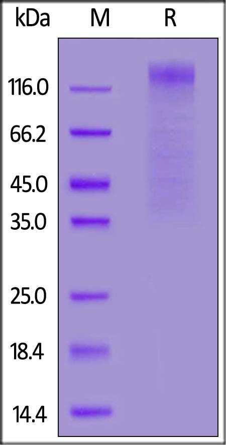 HCoV-NL63 S1 Recombinant Protein