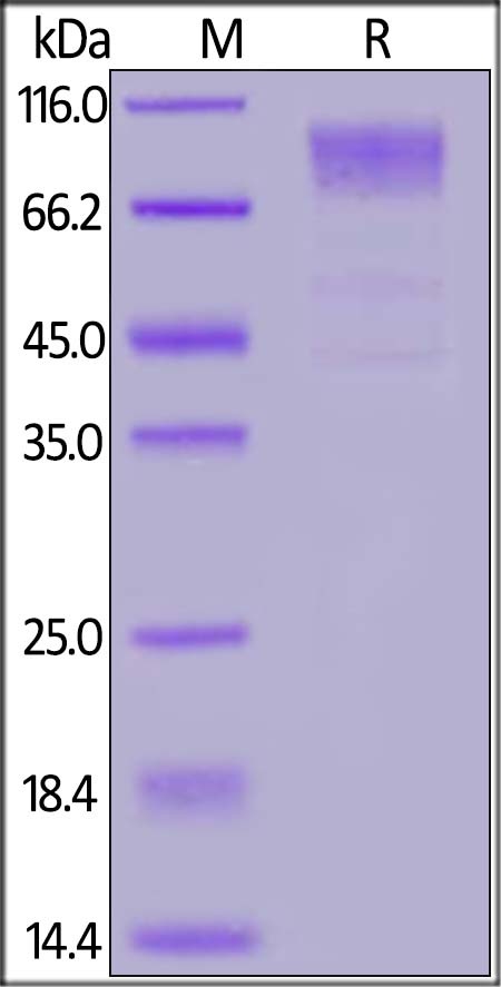 HCoV-229E S1 Recombinant Protein