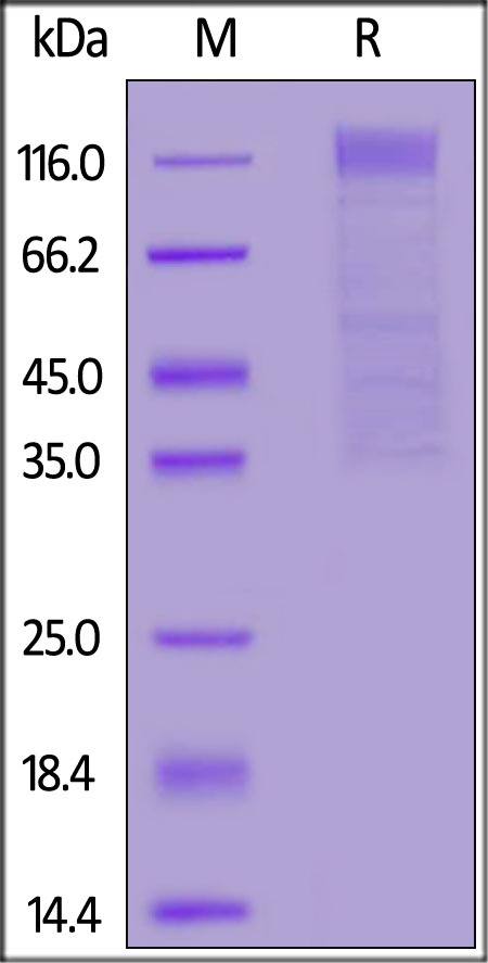 HCoV-HKU1(isolate N5) S1 Recombinant Protein