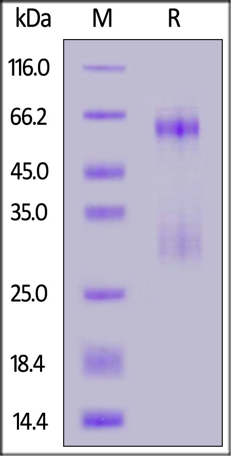 SARS-CoV-2 (COVID-19) Nucleocapsid Recombinant Protein